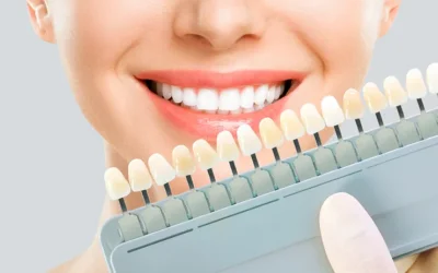 Blanchiment des dents : le guide ultime