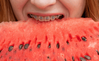 7 aliments qui nuisent à votre sourire… et ceux à privilégier