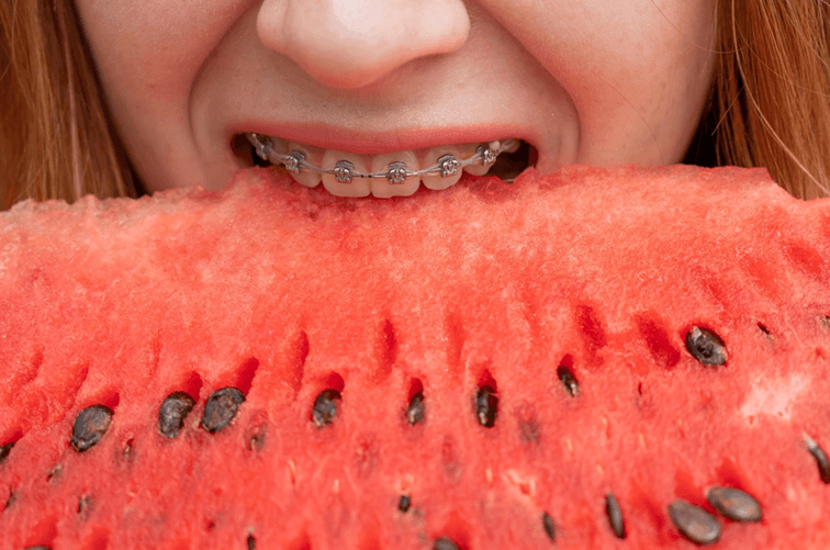7 aliments qui nuisent à votre sourire… et ceux à privilégier