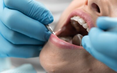 Les traitements de canal : Quand et pourquoi sont-ils nécessaires ?